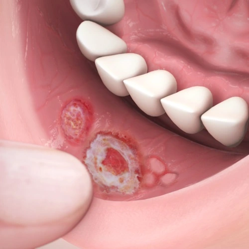 Oral & Dental Pathology Treatment Image