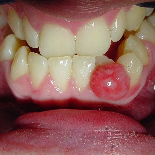 Oral & Dental Pathology Treatment Image