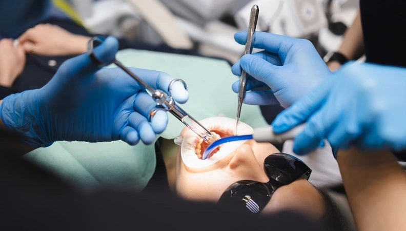 Surgical Tooth Extraction Image