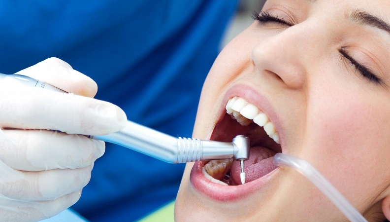 Best Teeth Cleaning in Gurgaon