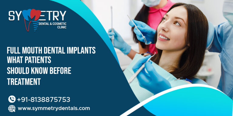 Full Mouth Dental Implants: What Patients Should Know Before Treatment