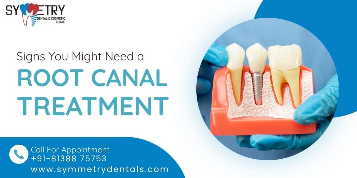 Root Canal Treatment